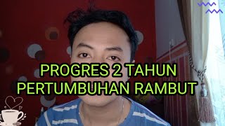 PROGRES 2 TAHUN PERTUMBUHAN RAMBUTMINOXIDIL 5 DAN FINASTERIDE 1MGANDROGENETIC ALOPECIA [upl. by Darryl]