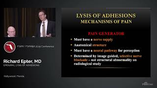 Dr Richard Epter Epidurolysis of Adhesions [upl. by Gonzalez228]