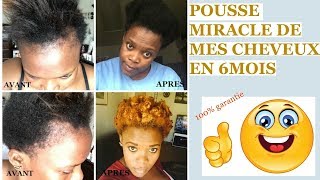 POUSSE MIRACLE DE MES CHEVEUX EN 6 MOIS MON TRAITEMENT  AMOR AMOUR [upl. by Eecrad]