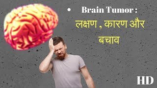 ये लक्षण नजर आए तो समझो ब्रेन ट्यूमर है  brain tumor symptoms  brain tumor symptoms and cure hd [upl. by Talbot]