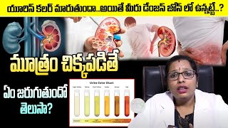 Kidney Stones Treatment  How to Reduce Kidney Stones  Kidney Health  UrinaryKidney Stones [upl. by Darrow]