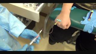 Butterfly Hand Phlebotomy Outside Vein Activationwmv [upl. by Ylecic]