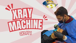 CH2  XRAY MACHINE [upl. by Tine]