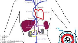 Circulação colateral na hipertensão portal [upl. by Lindly]