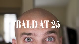 BALD AT 25 YEARS OLD [upl. by Adolpho414]