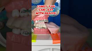 3 BEST and WORST HALLOWEEN CANDY for BRACES  TEETH 🎃👻🦷 braces candy crunchy [upl. by Oraneg]