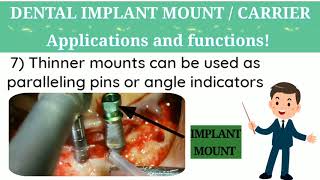 Dr VKs Dental Skool  Dental implant mounts  Dental implantologyBasics amp 100 other cool stuff [upl. by Atilegna]