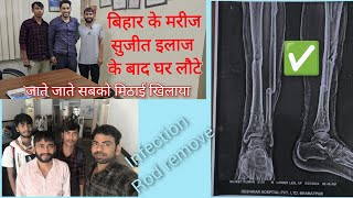 TIBIA FIBULA BONE FRACTURE INFECTION THA BIHAR SE ILAAJ KE LIYE AAYA THA MARIJ SUCCESSFUL TREATMENT [upl. by Helbonia]