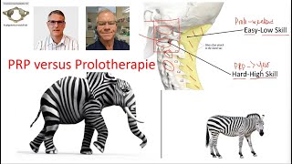 PRP versus Prolo  Instabile Wirbelsäule [upl. by Amarette]