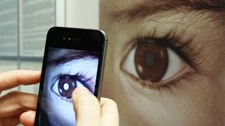 Detect Eye Cancer Retinoblastoma with Your Smart Phone – CHECT UK [upl. by Dhu]