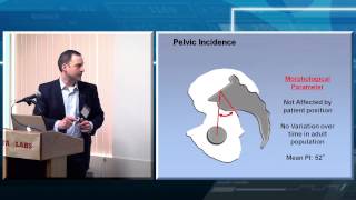 Sacropelvic Parameters and Principles [upl. by Rosner]