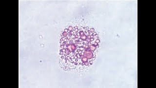 STAINING TECHNIQUES IN URINALYSIS [upl. by Annavahs525]