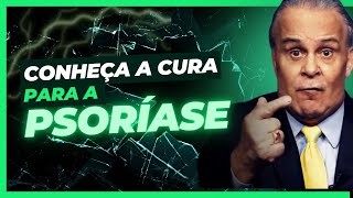 Dr Lair Ribeiro  Psoríase e outras doenças autoimunes  Motivacional [upl. by Eelorac]