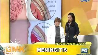 What is Meningitis [upl. by Fullerton]