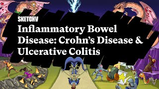 Inflammatory Bowel Disease Crohns Disease amp Ulcerative ColitisPart 1Sketchy MedicalUSMLE Step 2 [upl. by Latimore283]