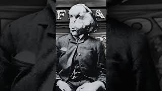 quotElephant Manquot  Human Freak Joseph Merrick uktruecrime history britishmystery [upl. by Eycal]