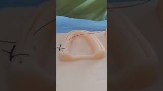 Suture techniques in oral cavity [upl. by Elocen621]