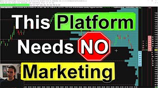 Is there a BEST Trading Software [upl. by Nahtahoj]