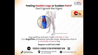 Swollen Legs or Sudden Pain Could be deadly Thrombosis [upl. by Eizzil748]