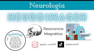 Neuroimagen  Resonancia Magnética [upl. by Inaluiak]