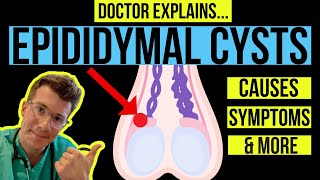 Doctor explains TESTICULAR LUMPS PART 1  EPIDIDYMAL CYSTS causes symptoms and treatments [upl. by Ettevol]