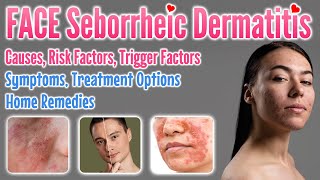 Seborrheic Dermatitis Face Causes Risk amp Trigger Factors Symptoms Treatment Options Home Remedies [upl. by Holli]