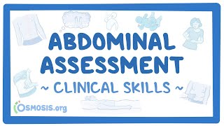 Abdominal Assessment Clinical Skills [upl. by Erreit]