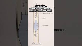 Urinometer l Urine Test urine medical pathology biochemistry lab shorts [upl. by Kiona]