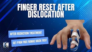 Finger Reset After Dislocation [upl. by Nameerf]