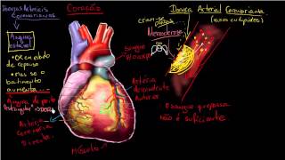O que é Doença arterial coronariana [upl. by Irrot]
