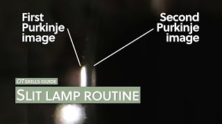 OT skills guide Slit lamp routine [upl. by Ihsir934]