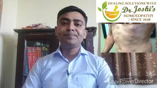 Lipoma Homeopathic Medicine For lipoma [upl. by Scrivenor]