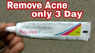 Supatret C Gel review in Hindi [upl. by Sauncho]