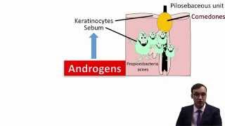 Acne Vulgaris [upl. by Anidualc722]