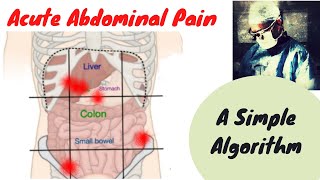 ACUTE ABDOMEN ASSESSMENT IN ER SUPER QUICK [upl. by Ferdinande609]