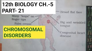 Class 12 biology chapter 5part 21chromosomal disordersby study with Farru [upl. by Naik]