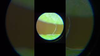 Hidden Wonders of a Terrarium under a Microscope shorts [upl. by Llatsyrc]