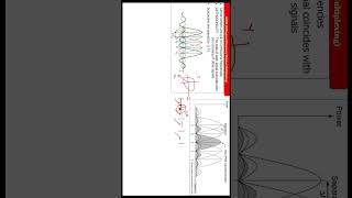 What is OFDM Orthogonal Frequency Division Multiplexing in HINDI Part 1 [upl. by Nossila692]