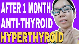 1 MONTH NA PAG INOM KO NG ANTITHYROID DRUG METHIMAZOLE TAPDIN HYPERTHYROID [upl. by Attenat205]