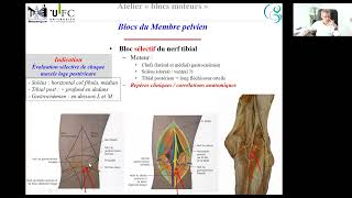 bloc moteur partie 3 MI [upl. by Annoid]