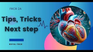 Cardiac Imaging  Tips Tricks and Next Step for FRCR 2a [upl. by Llirret]