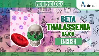 Beta thalassemia Major  Histo pathology  RBC Morphology  English [upl. by Ocirrej]