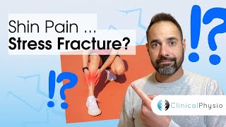 Is Your Shin Pain a Stress Fracture  Expert Physio Guidance [upl. by Anifares]