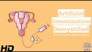 Artificial Insemination Explained Making Informed Choices [upl. by Kline]