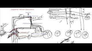 Congenital Adrenal Hyperplasia [upl. by Ensoll]