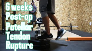 6 Weeks Patellar tendon rupture surgery update [upl. by Laon683]