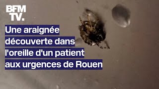 Une araignée retrouvée dans loreille dun patient aux urgences de Rouen [upl. by Yemane]