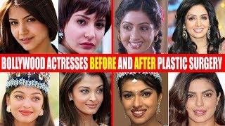 SHOCKING Plastic Surgery of Bollywood Actresses BEFORE amp AFTER  SrideviAnushkaAishwaryaPriyanka [upl. by Deni791]