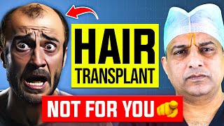 10 Reasons  Do Not Get A Hair Transplant  Hair Surgeon Reacts [upl. by Clintock]