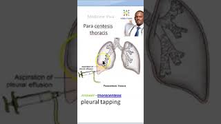 Medicine ParaCentesis thoracis viva [upl. by Emmery]